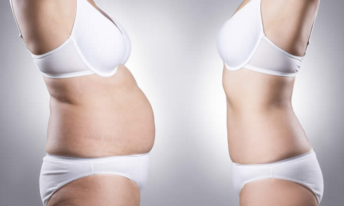 Liposuzione 2019 - Spiegata Bene - Funziona? Costo e Benefici