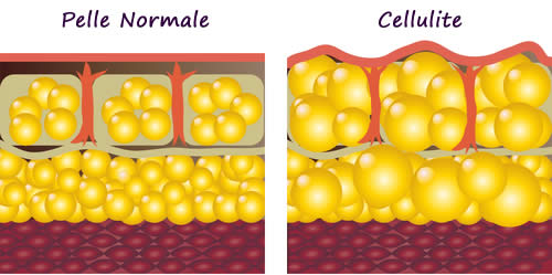 tessuto adiposo sano e cellulite