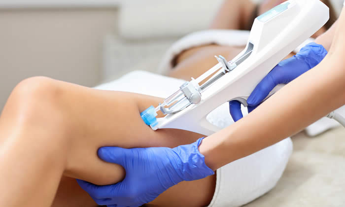 Mesoterapia per Dimagrire: Funziona? Benefici e Svantaggi