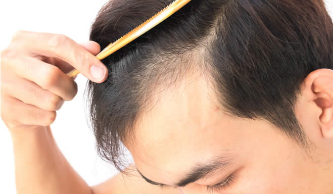 caduta dei capelli