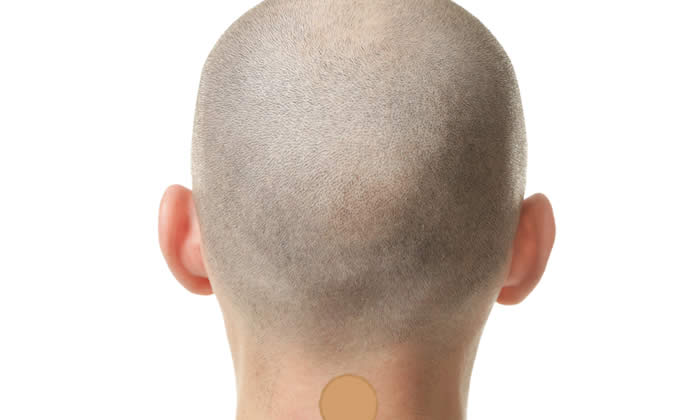 Cerotti AntiCaduta 2019 - Funzionano Contro la Caduta dei Capelli?