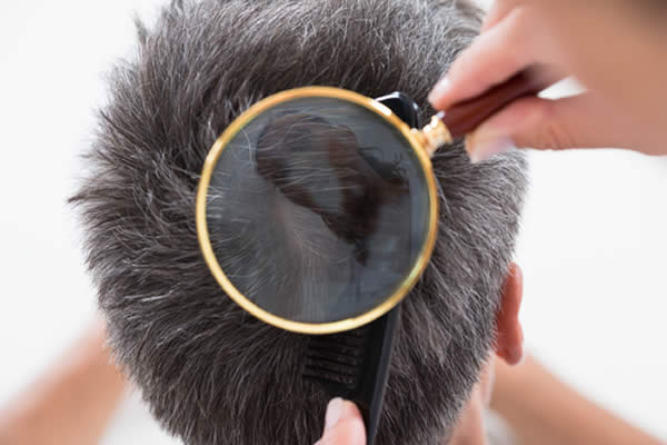 Cheratina 2019 - Cos'è? Come Funziona? Struttura, Funzioni e Capelli