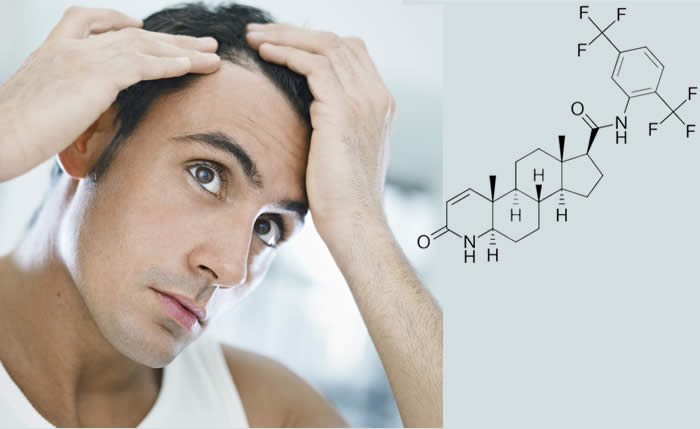 Dutasteride 2019 - Uso ed Efficacia Contro la Caduta dei Capelli