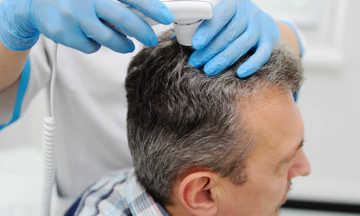 Diagnosi Alopecia - Esami per Capelli che Cadono: Quali Fare?