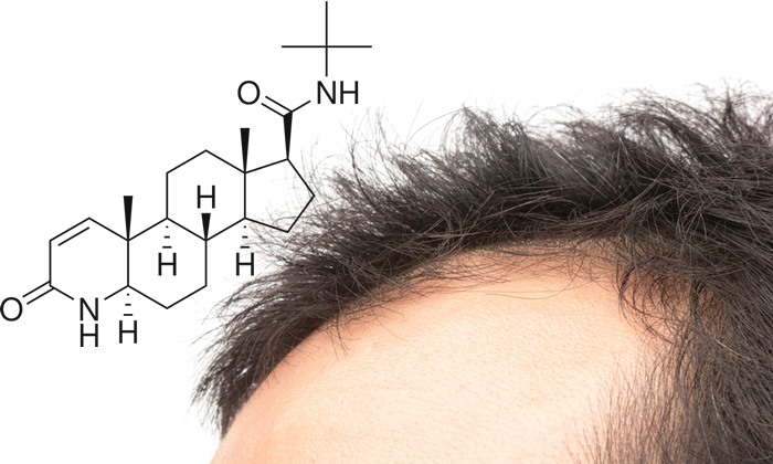 Finasteride e Capelli 2019 - Funziona? Uso, Efficacia, Effetti Collaterali