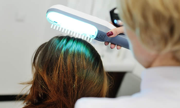 Laser Capelli 2019 - Effetti Anticaduta - Funziona? Prezzo e Benefici