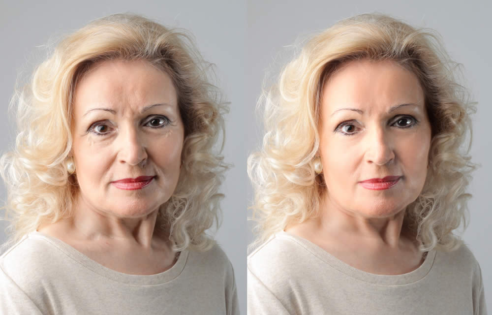 Crema al Collagene
