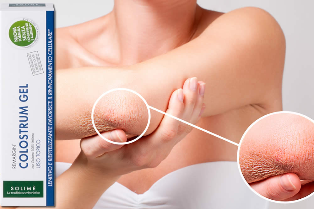Colostrum Gel 2019 - A Che Serve? Effetti Sulla Pelle, Prezzo, Opinioni