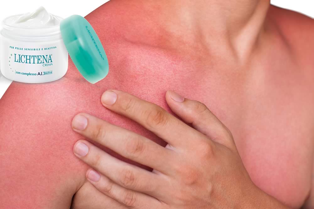 Lichtena Crema 2019 - Uso, INCI, Benefici per la Pelle Irritata - Opinioni