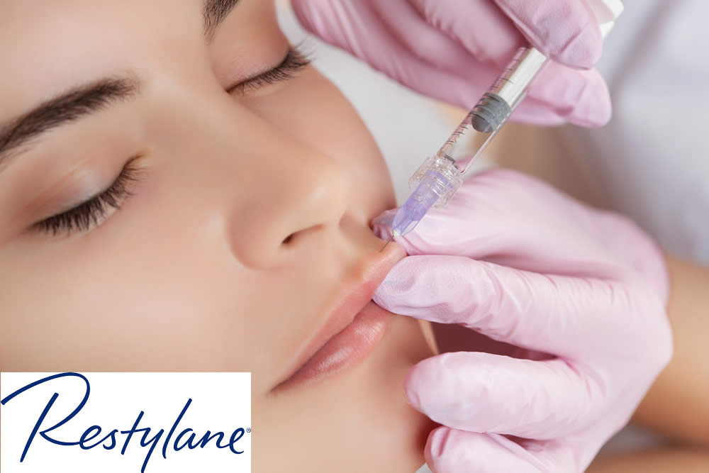 Restylane 2019 - Filler Acido Ialuronico - Tipi, Uso, Prezzo e Opinioni