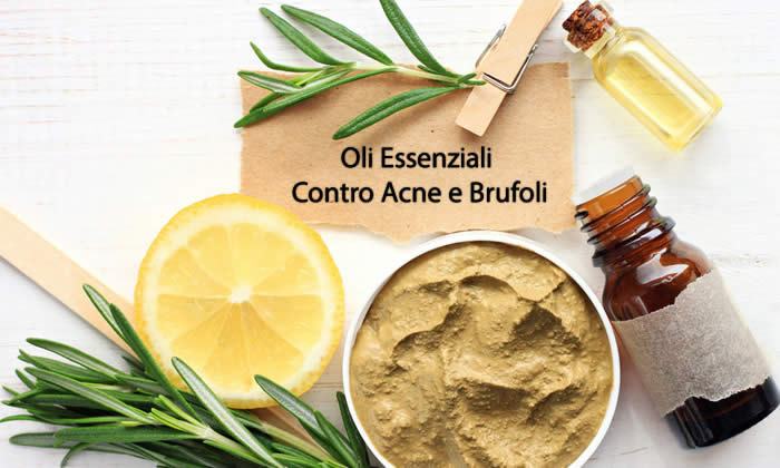 Acne e Brufoli Addio: Oli Essenziali e Ricette Fai da Te