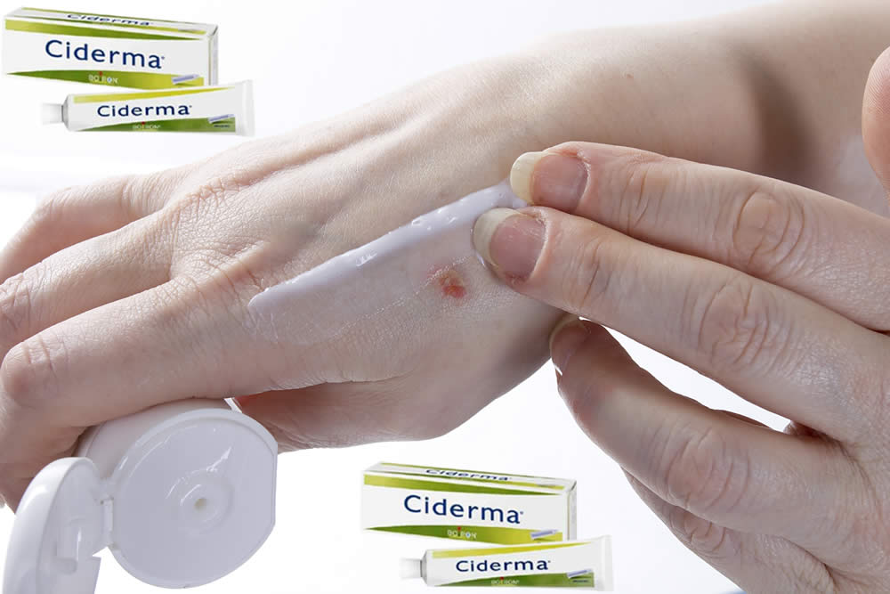 Ciderma 2019 - Pomata Omeopatica per Dermatite: Uso e Opinioni