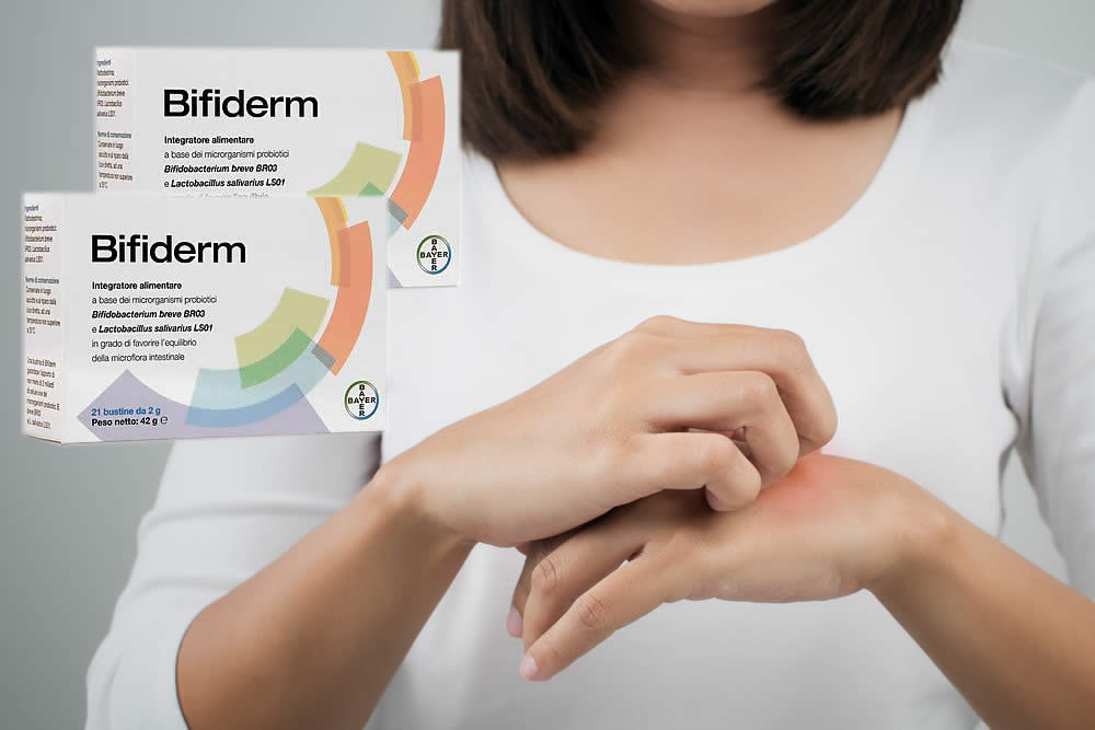 Bifiderm 2019: Allergie e Dermatite Atopica: Funziona? Opinioni