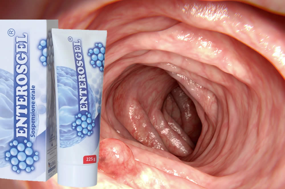 Enterosgel 2019 è una Bufala? Funziona? Fa Male? Opinioni e Consigli