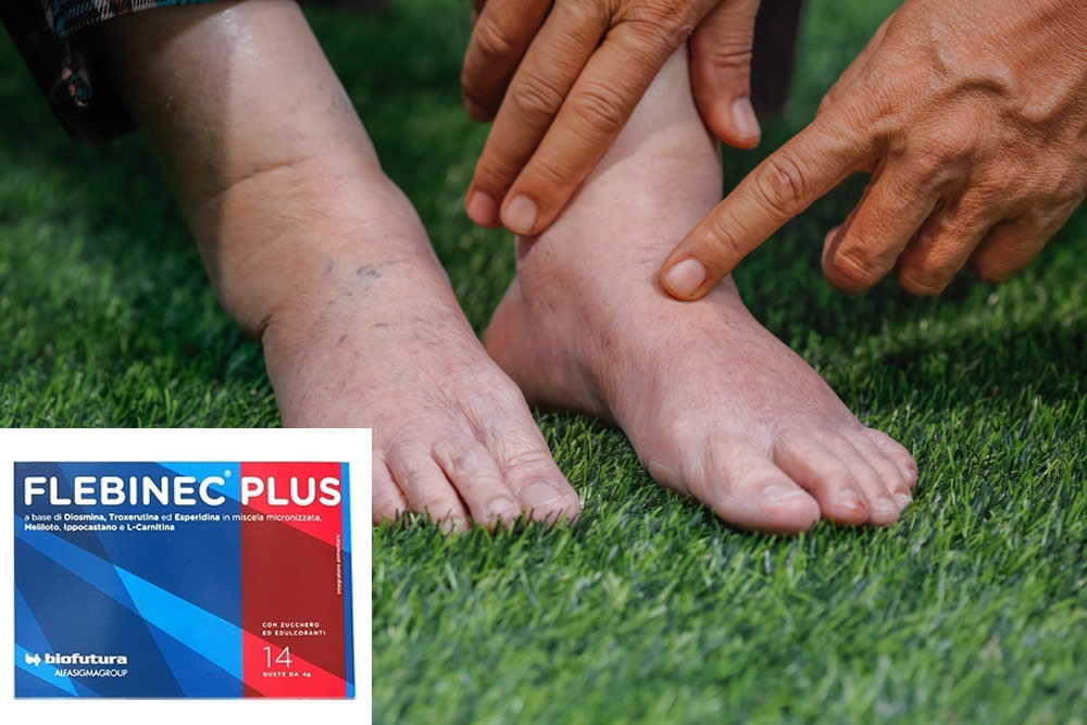 Flebinec Plus 2019 - Recensione, Uso, Prezzo e Offerte