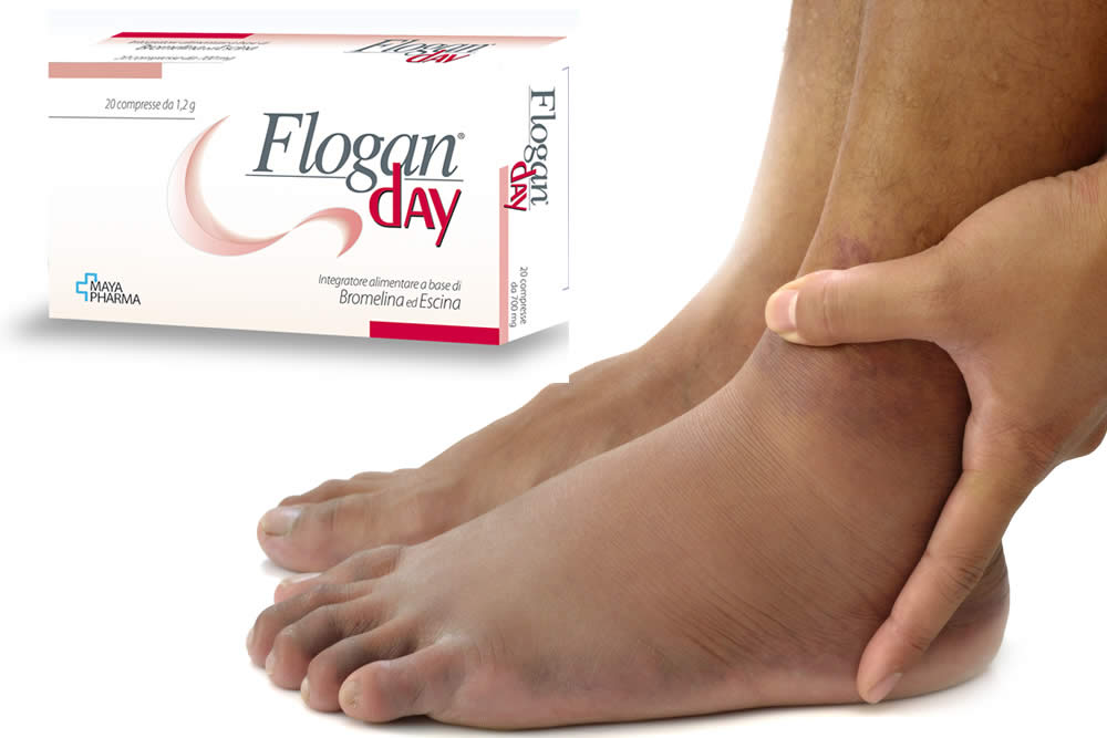 Flogan Day 2019 - Contro Edemi ed Ematomi? Funziona? Opinioni