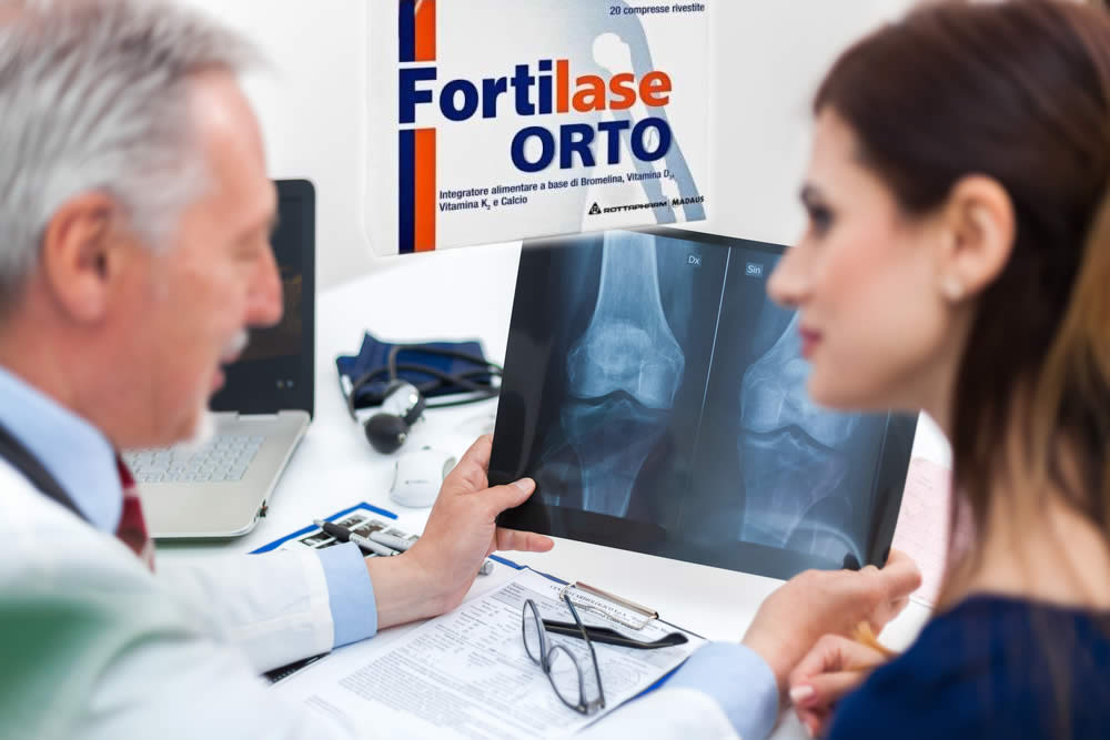 Fortilase Orto | Recensione 2019 | Uso, Prezzo, Opinioni