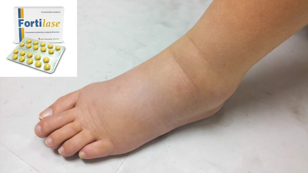 Fortilase 2019: Funziona? Recensione, Efficacia, Uso e Prezzo