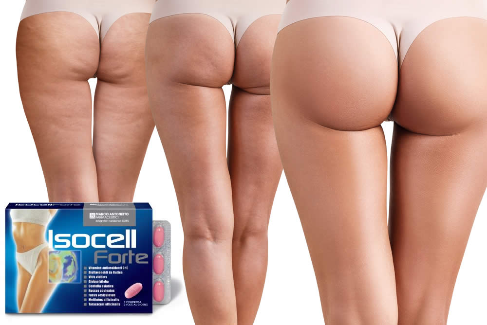 Isocell Forte - Recensione 2019 - Addio Cellulite? Funziona?