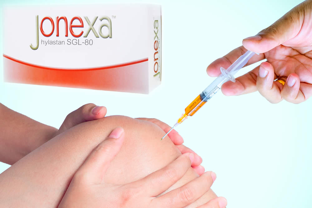 Jonexa 2019 - Iniezioni contro l'Artrosi: Funzionano? Recensione