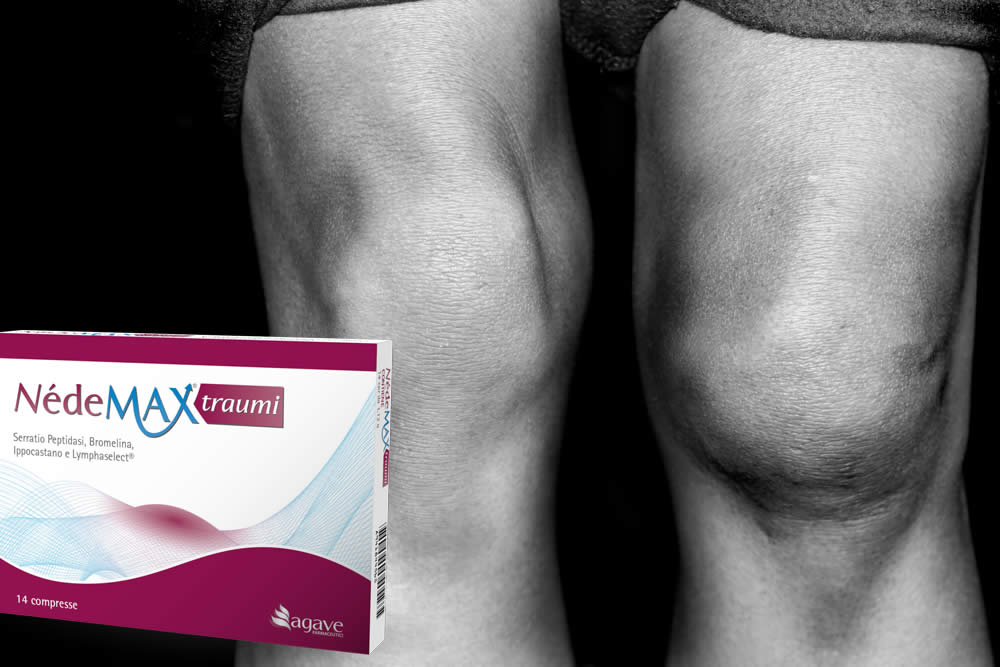 Nedemax Traumi 2019 - Funziona? Fa Male? Recensione e Prezzo
