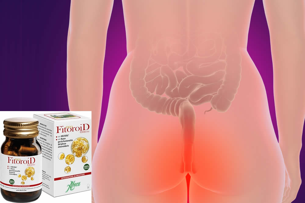 Neo Fitoroid 2019 - Funziona per le Emorroidi? Recensione