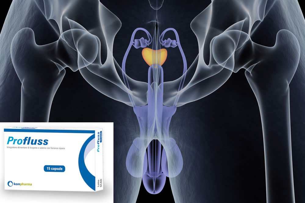 Profluss 2019 e Prostata - Funziona? Fa Male? Uso e Recensione