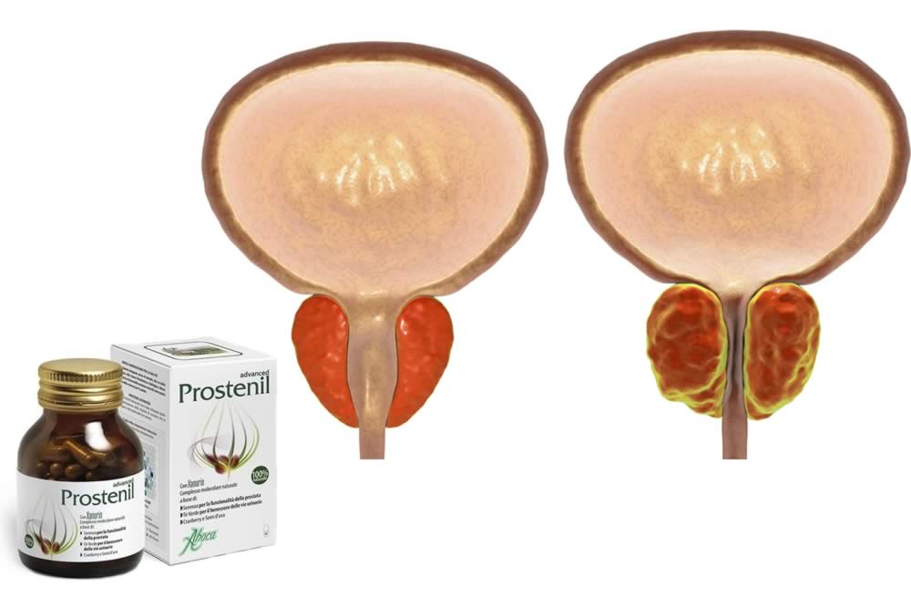 Prostenil Advanced 2019 - Funziona? Recensioni, Efficacia, Offerte