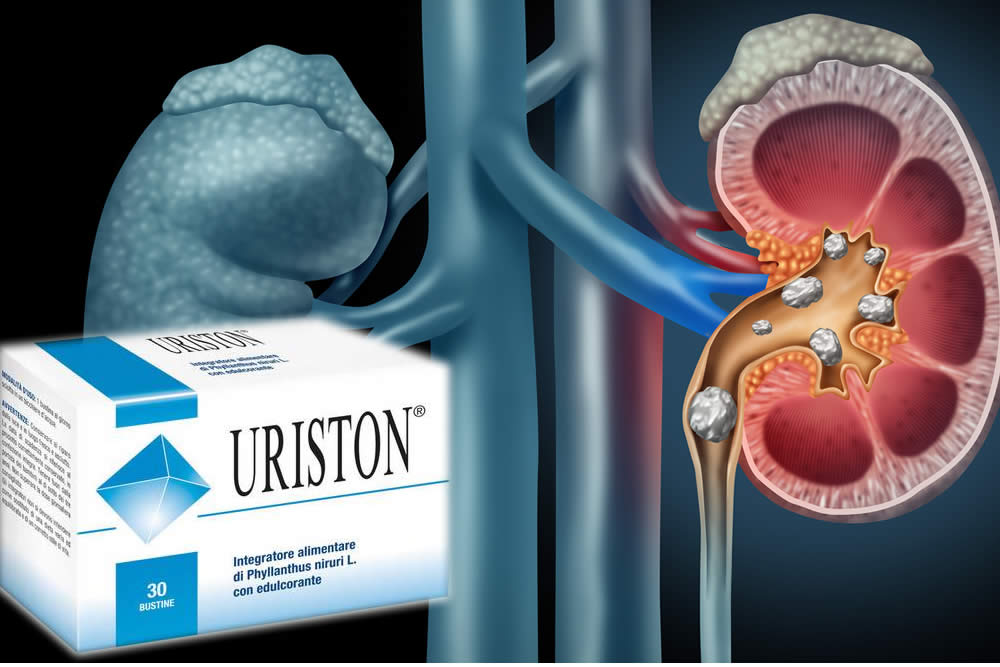 Uriston Plus e Calcoli Renali - Funziona? Opinioni 2019
