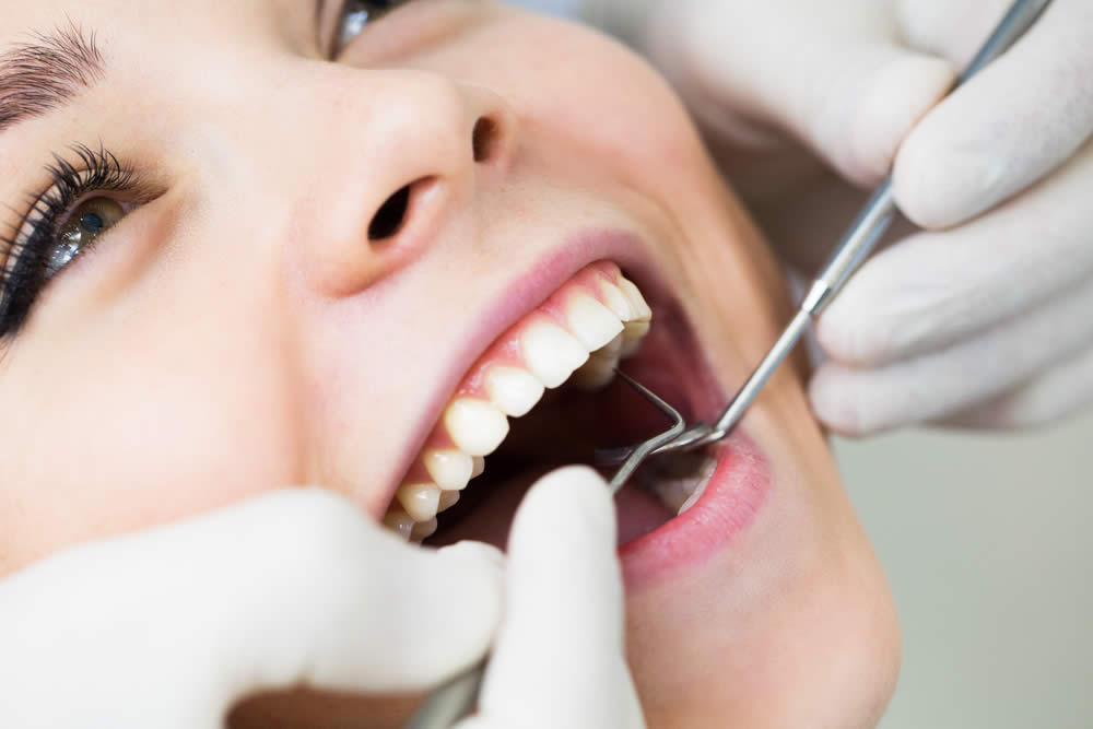 Rimedi Gengivite 2019 - Cosa Fare per Prevenire e Curare le Gengiviti