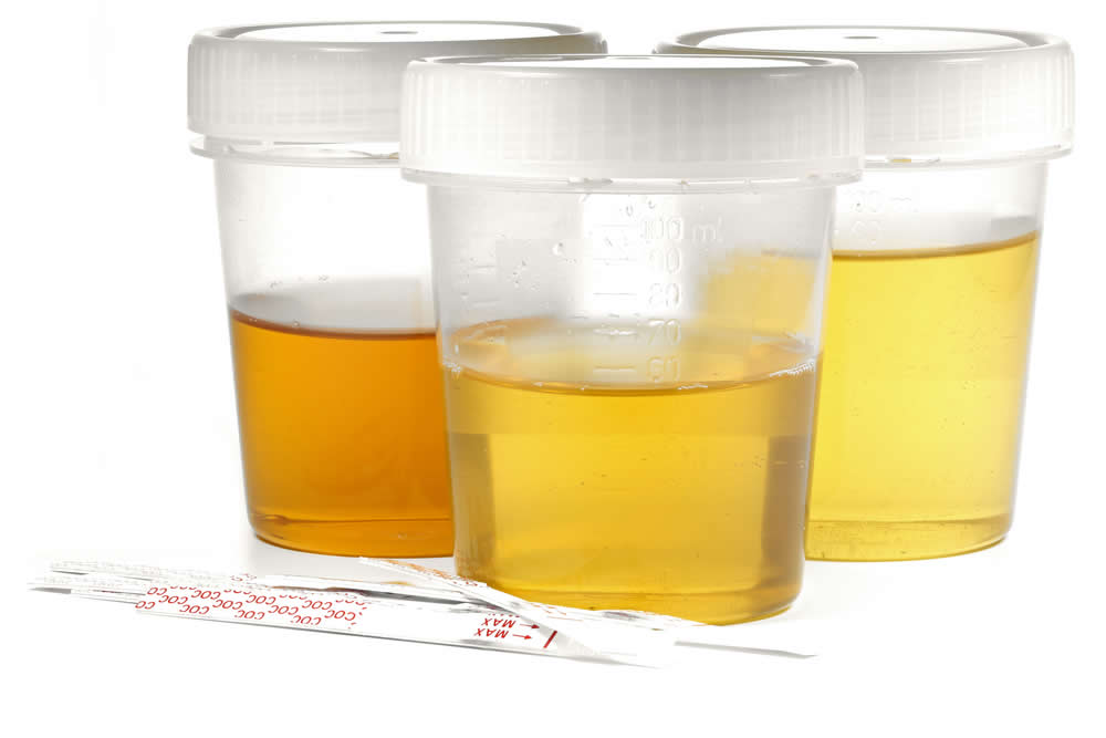 Cocaina nelle Urine - Come e Per Quanto Tempo si rintraccia