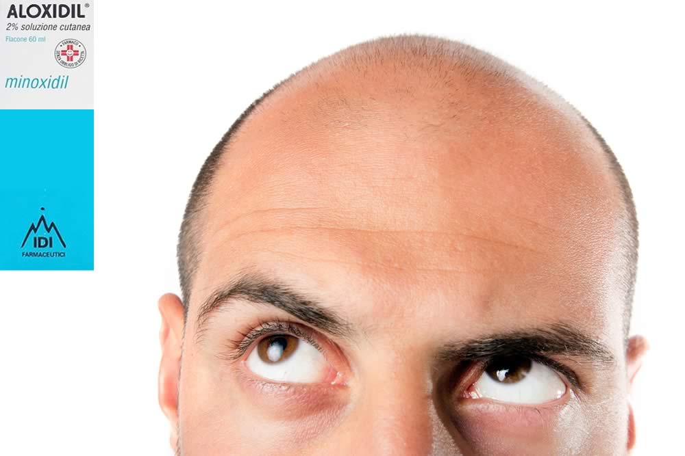 Aloxidil - Minoxidil 2% - Foglio Illustrativo 2019 Spiegato