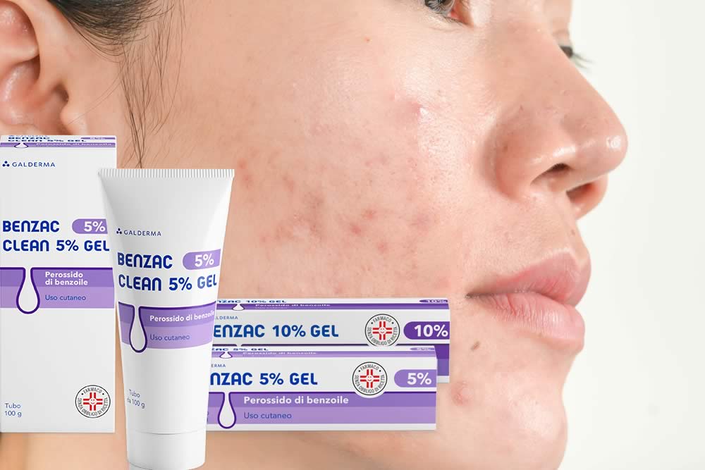 Benzac Gel 2019 - Funziona? Prezzo, Opinioni e Foglietto Spiegato
