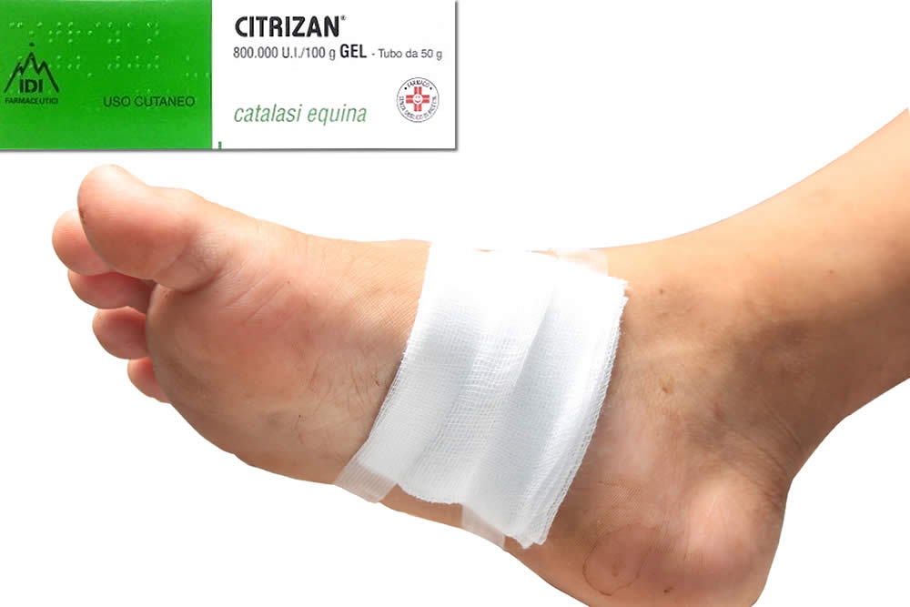 Citrizan Gel 2019 - A Cosa Serve? Uso e Foglietto Spiegato