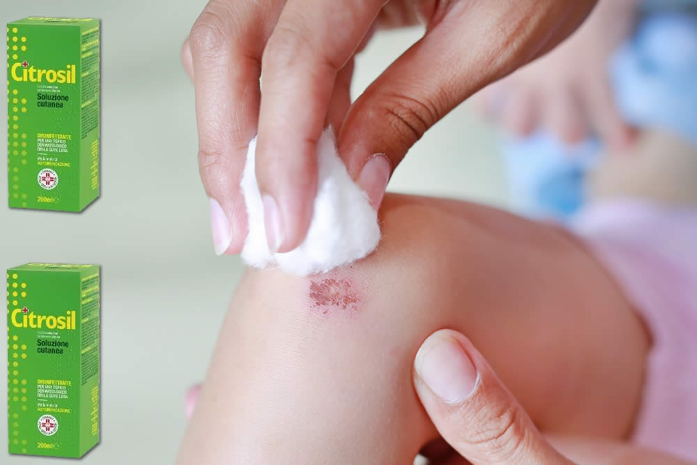 Citrosil 2019 - Disinfettante Spray, Soluzione, Garze - Farmaco Spiegato