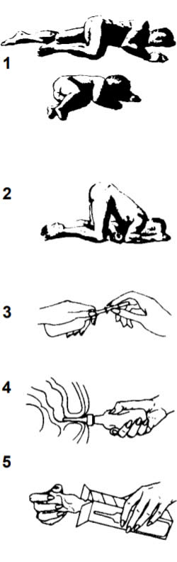 clisma-lax-istruzioni