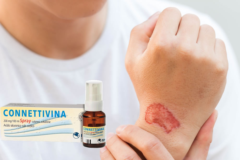 Connettivina Spray - Uso, Prezzo e Foglietto Illustrativo 2019 Spiegato