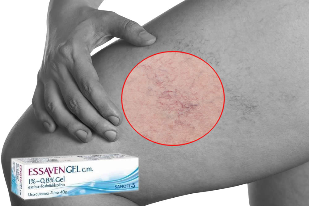 Essaven - Gel per Gambe Gonfie e Pesanti: Foglio Illustrativo Spiegato