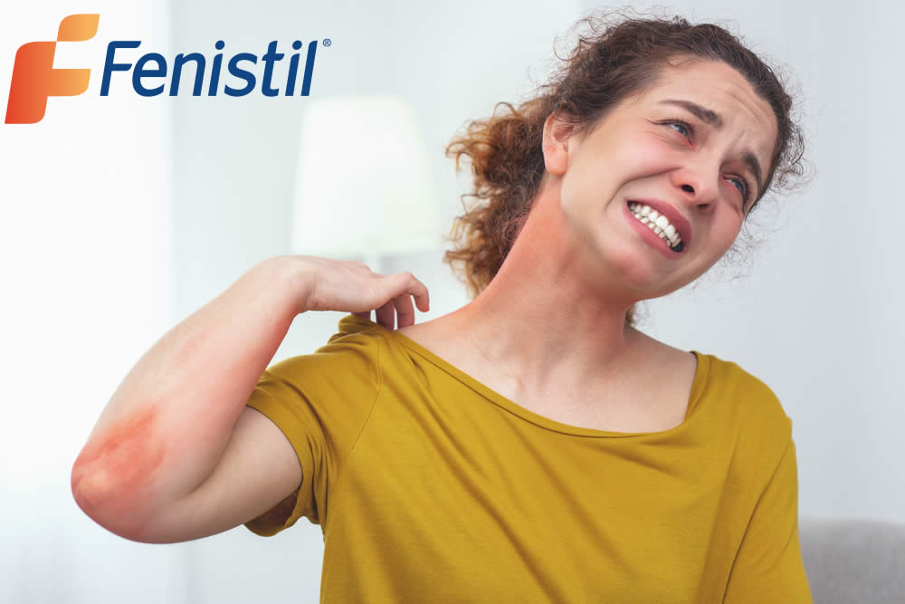 Fenistil 2019 - Farmaco Spiegato - Benefici, Prezzo e Foglio Illustrativo