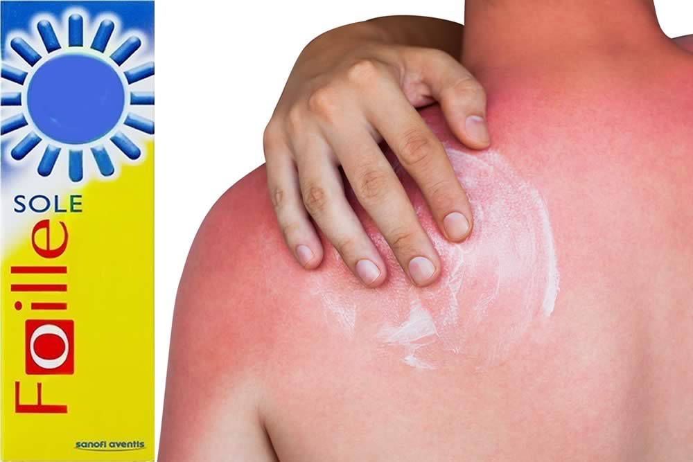 Foille Sole 2019 - Crema e Spray - Spiego Benefici ed Effetti Collaterali