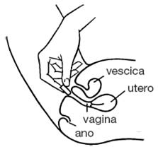 gynocanesten ovuli istruzioni