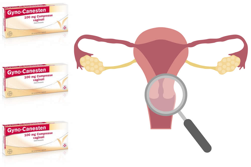 Gyno Canesten Ovuli 2019 - Consigli e Foglietto Illustrativo Spiegato