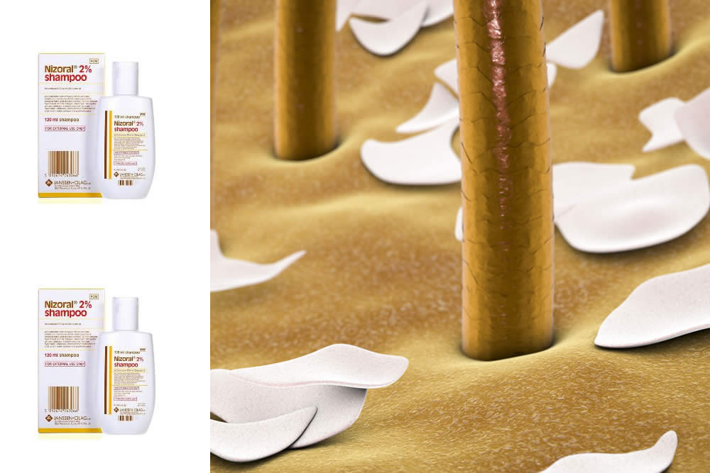 Nizoral Shampoo 2019 - Forfora e Dermatite Seborroica - Bugiardino