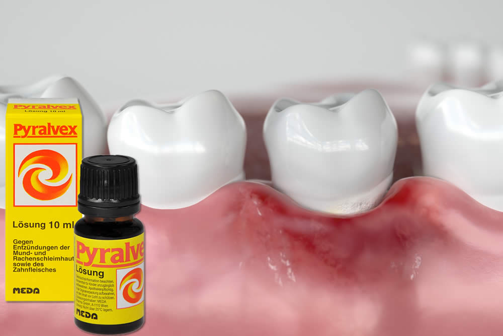 Pyralvex 2019 - Contro le Afte - Farmaco Spiegato e Foglio Illustrativo