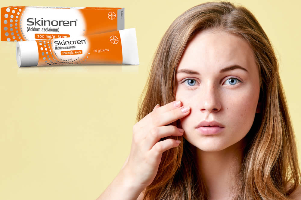 Skinoren 2019 - Crema per l'Acne - Uso, Efficacia e Foglio Illustrativo
