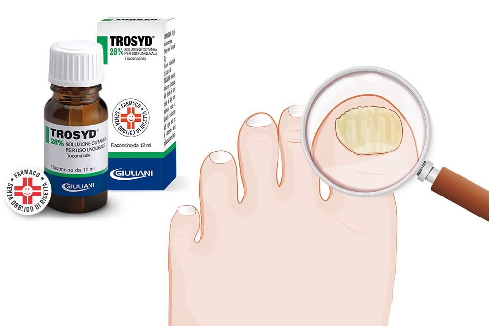 Trosyd ® Smalto per Unghie - Onicomicosi - Foglio Illustrativo Spiegato