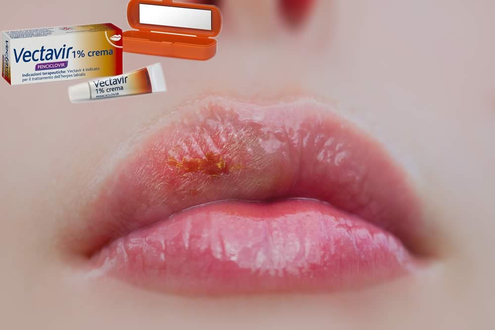 Vectavir Crema 2019 - Herpes Labiale - Uso, Prezzo e Foglio Illustrativo