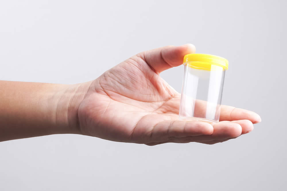 Costo Spermiogramma - Prezzo Esame Medico e del Test fai da Te