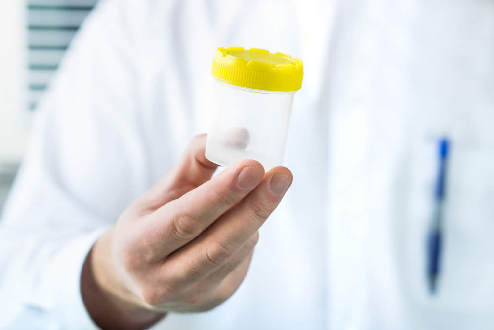 Spermiogramma Spiegato - Che Cos'è? Come si Fa? Valori Normali