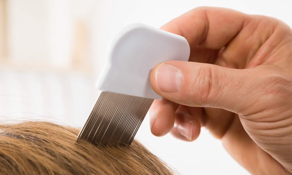 Pettini Pidocchi - Efficacia AntiPidocchi e Guida all'Acquisto
